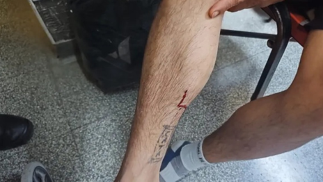 Asaltaron a un vecino de La Plata y lo balearon en una pierna para intentar robarle la moto Asaltaron a un vecino de La Plata y lo balearon en una pierna para intentar robarle la moto