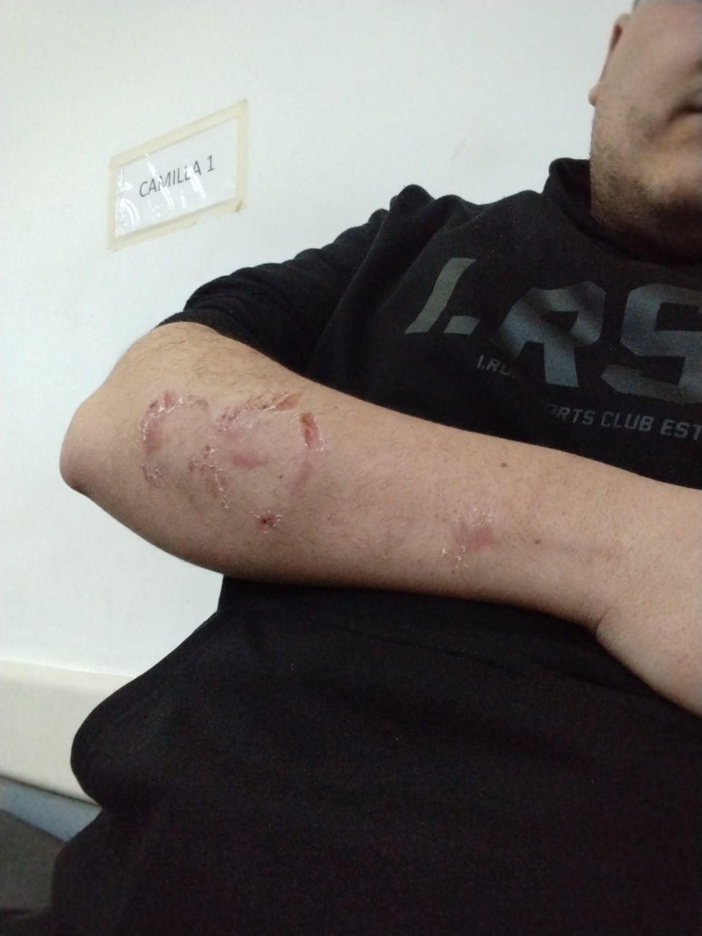 El hombre fue herido en su brazo y espalda tras el ataque 