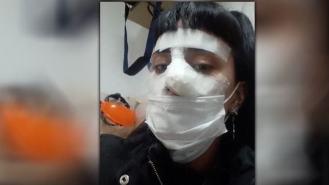 golpiza, sangre y rotura de tabique en otro caso de violencia de genero en la region