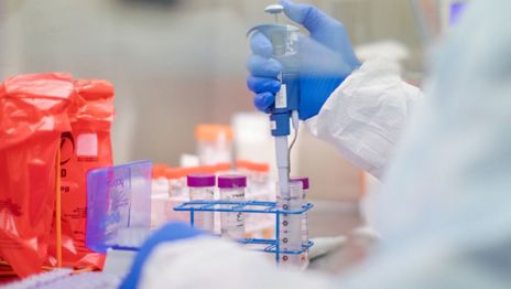 Kraken, la nueva mutación de la variante Ómicron del COVID, ya está en Chile y Brasil