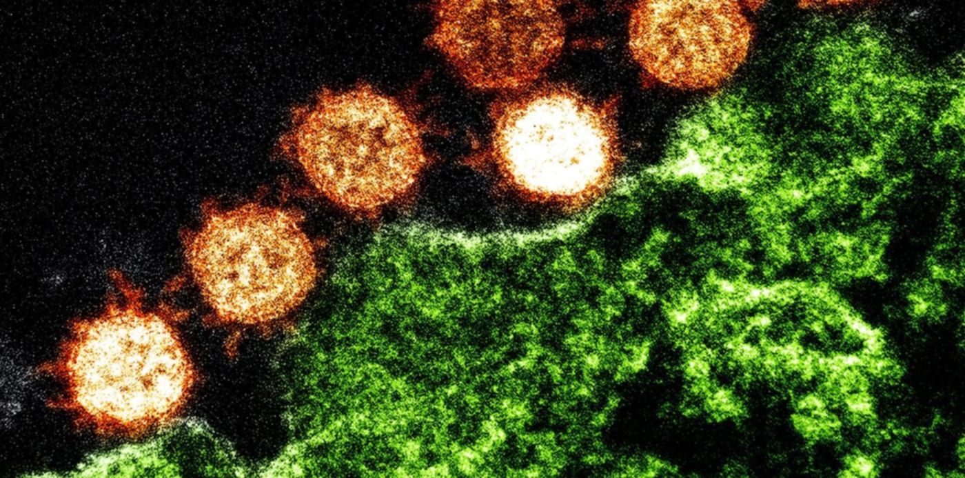 1580068416397.jpg?rotate=0&oh=999&height=740&scaleX=1&scaleY=1&ow=1500&x=7&y=239&width=1480&&cw=1920&ch=950