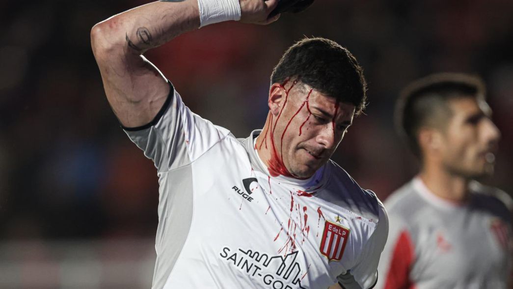 La imagen de Matías Mansilla con la cabeza ensangrentada que no fue suficiente para el árbitro