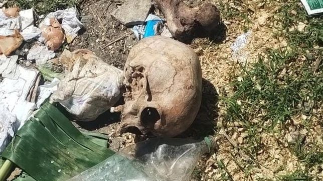encuentran craneos y huesos humanos en un basural de la plata