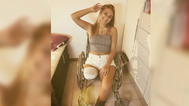 juana, la joven platense que perdio una pierna y lucha por una ciudad igualitaria