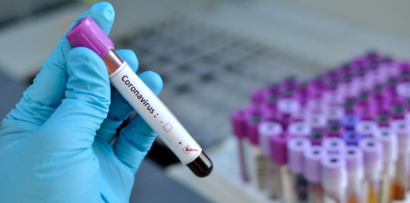 1584104954298.jpg?&cw=1920&ch=950