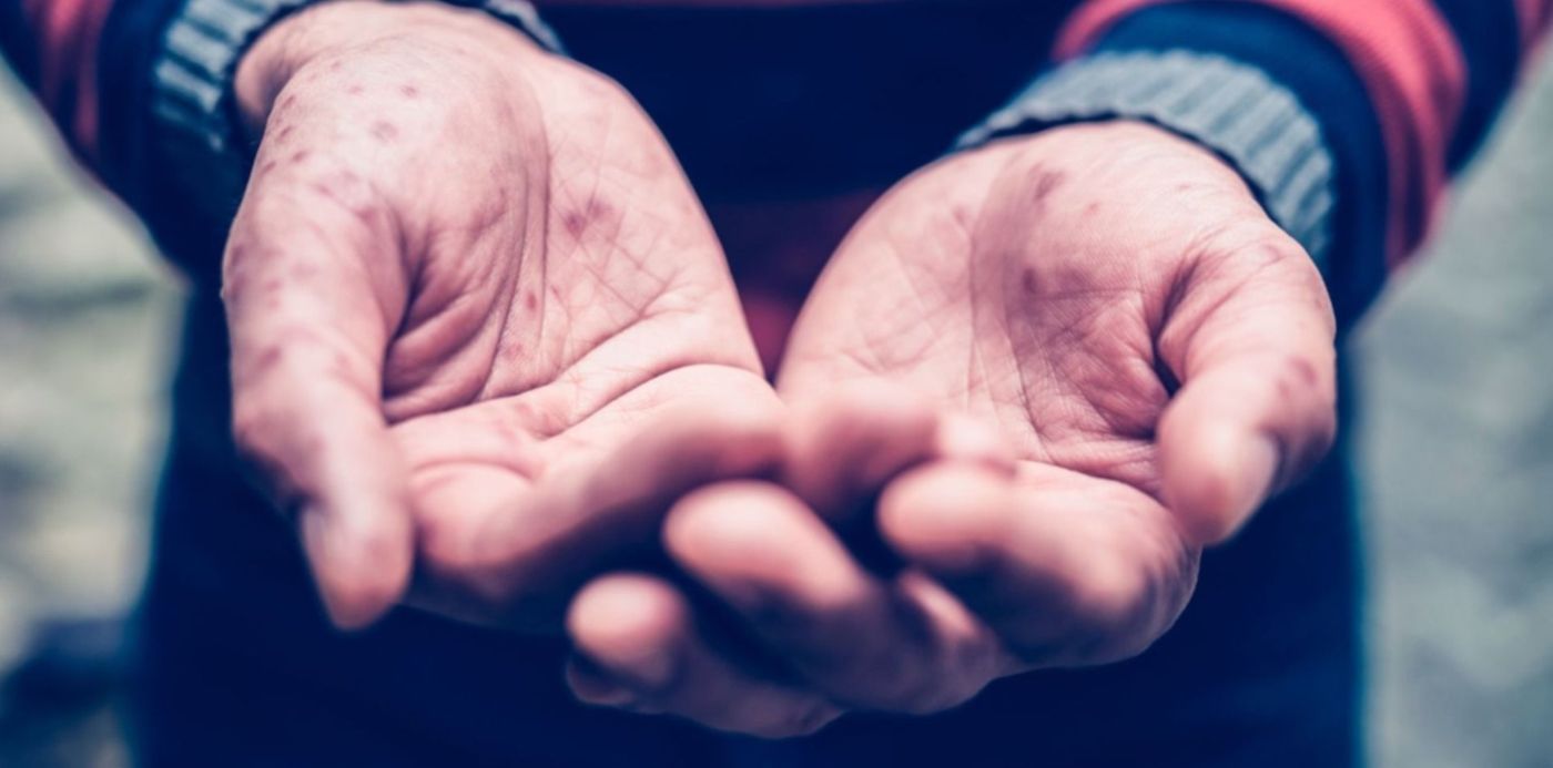 1653314250499.jpg?x= 3&y=93&width=1500&height=750&rotate=0&scaleX=1&scaleY=1&ow=1500&oh=843&&cw=1920&ch=950