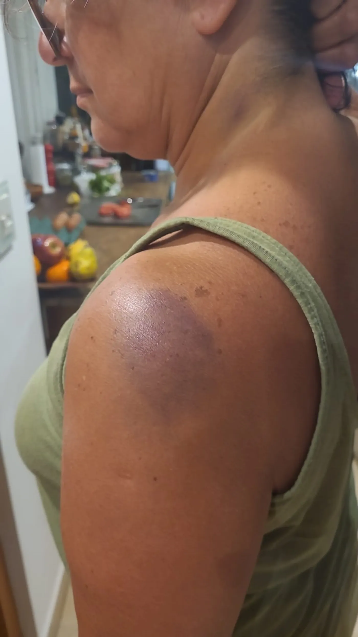 Silvia Lo'Presti fue atacada brutalmente en Pinamar.