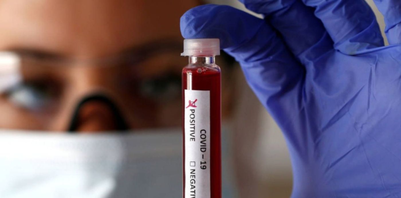 1614890849657.jpg?x=0&y=120&width=1194&height=597&rotate=0&scaleX=1&scaleY=1&ow=1200&oh=900&&cw=1920&ch=950