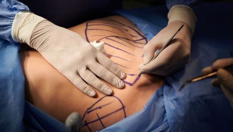 Arrancó el juicio por el caso de la Silvina Luna platense que busca probar una mala praxis médica