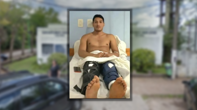 fue por una cirugia de rodilla a una clinica de la plata y le operaron las dos piernas