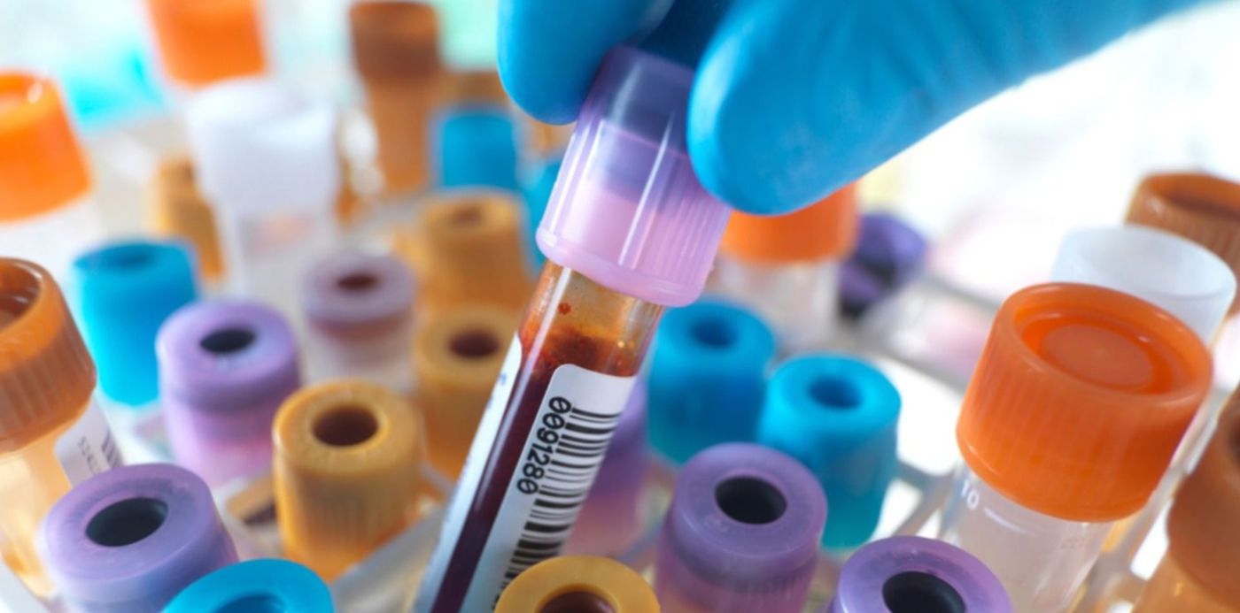 1587522143388.jpg?ow=1500&oh=1124&y=92&height=737&scaleX=1&scaleY=1&x=10&width=1475&rotate=0&&cw=1920&ch=950