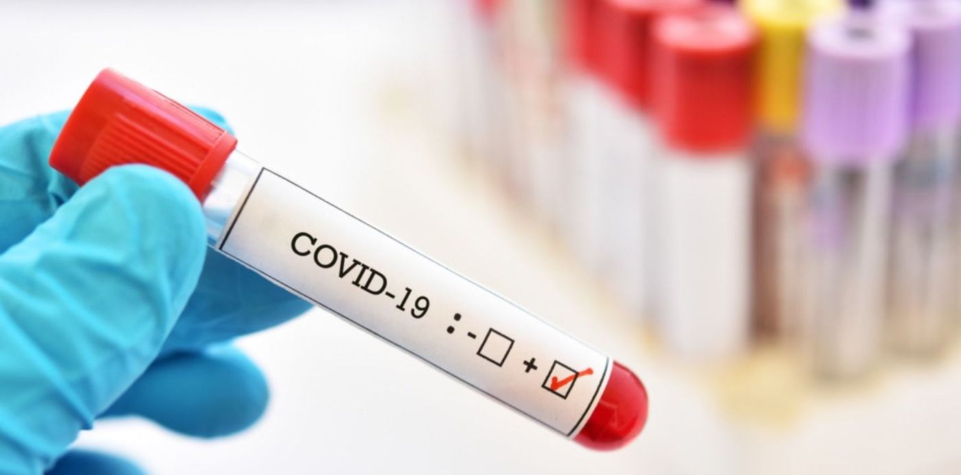 1585424742908.jpg?width=1487&scaleX=1&scaleY=1&x=17&y=50&height=743&rotate=0&ow=1500&oh=1000&&cw=1920&ch=950