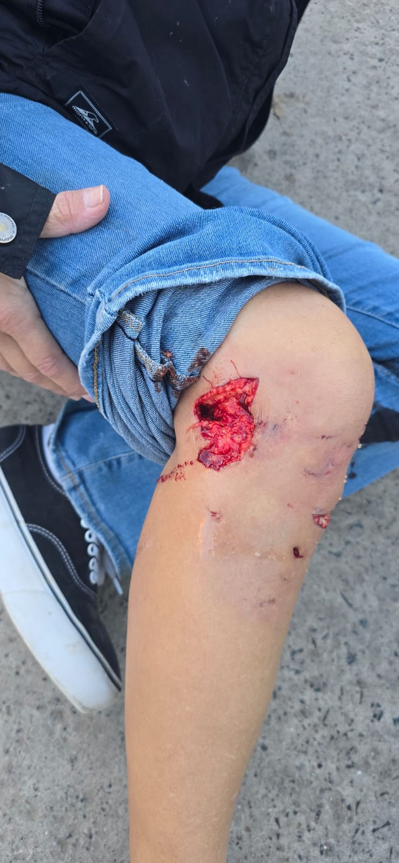 La mujer atacada en La Plata tuvo que ser llevada al Hospital San Roque de Gonnet y recibió curaciones.