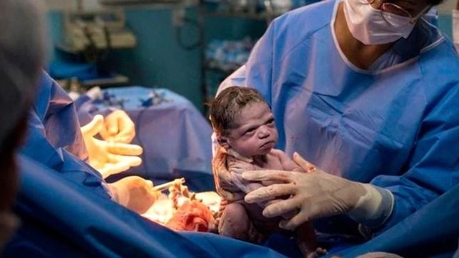 la insolita foto de una bebe que nacio ?enojada? y se hizo viral