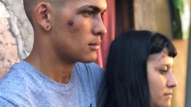 tras ser dada de alta, hablo la joven atacada en diagonal 80: me podria haber matado