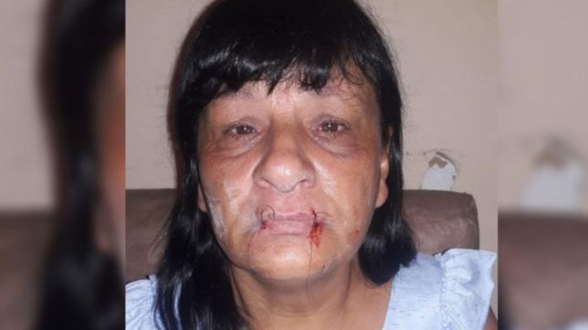 una dirigente social de la plata se cosio la boca para que liberen a su hijo