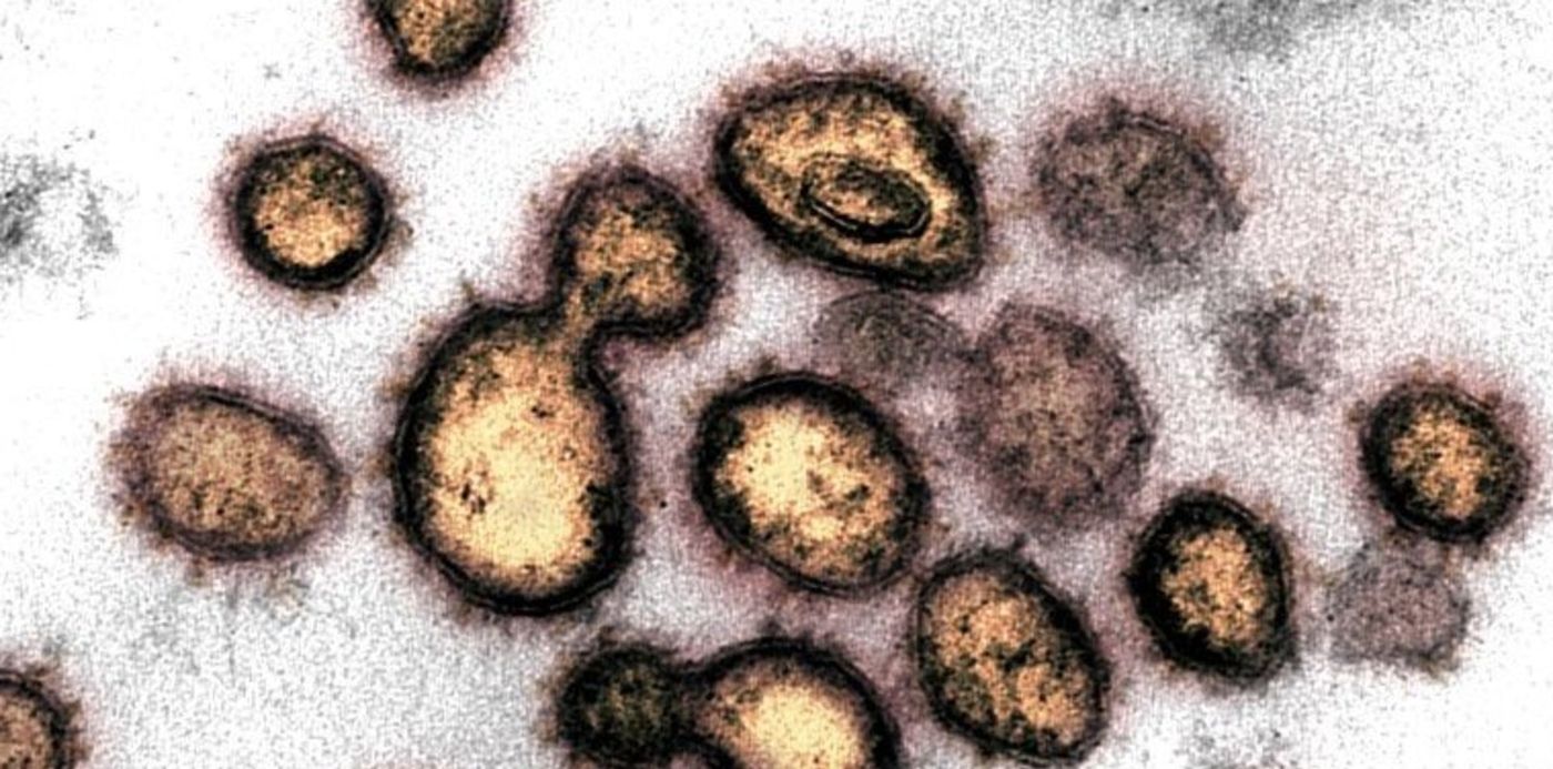 1594132571564.jpg?x=3&y=43&width=759&height=380&rotate=0&scaleX=1&scaleY=1&ow=768&oh=512&&cw=1920&ch=950