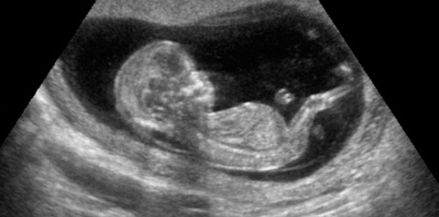 1548848263169.jpg?rotate=0&scaleY=1&ow=953&oh=536&x=1&y=63&width=946&height=473&scaleX=1&&cw=1920&ch=950