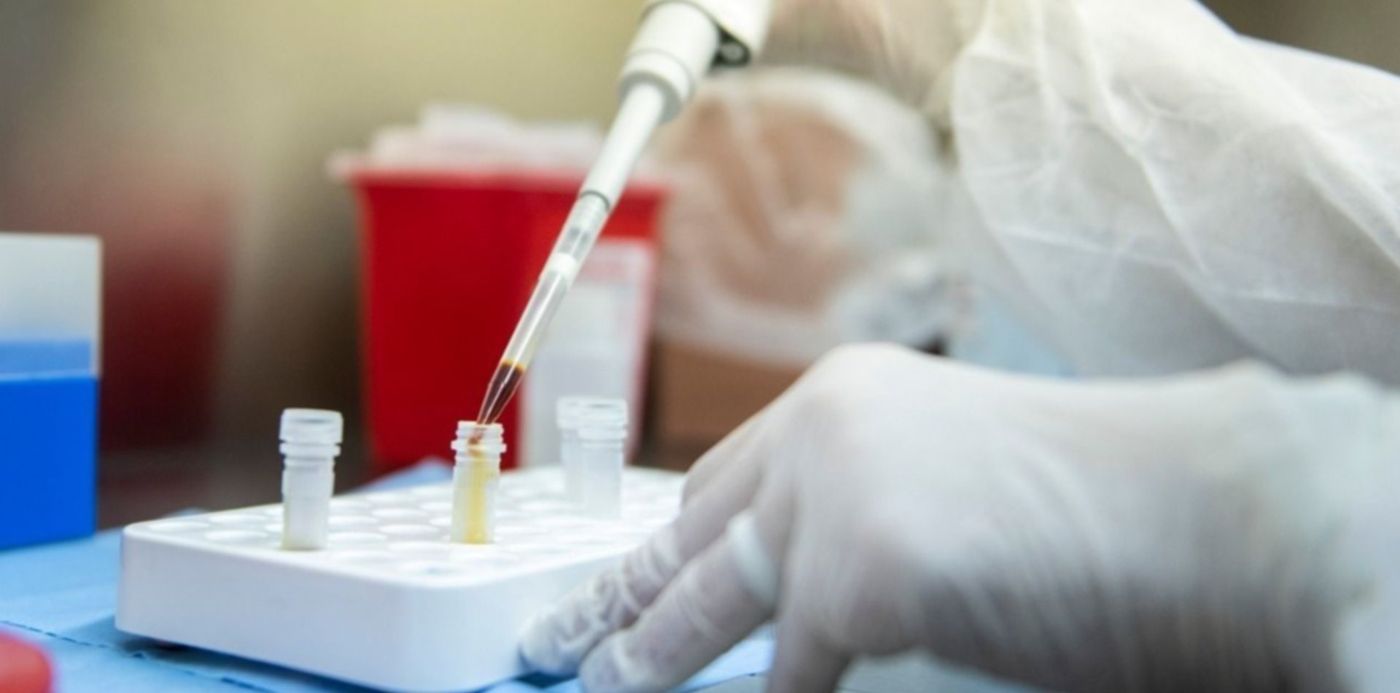 1585839940529.jpg?x=5&y=143&width=1270&height=635&rotate=0&scaleX=1&scaleY=1&ow=1280&oh=799&&cw=1920&ch=950