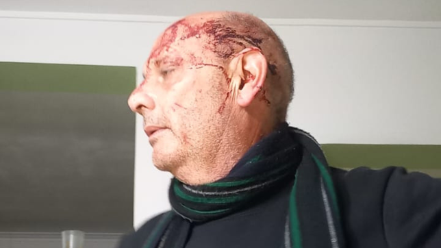 dos jubilados fueron golpeados por ladrones en medio de un feroz robo