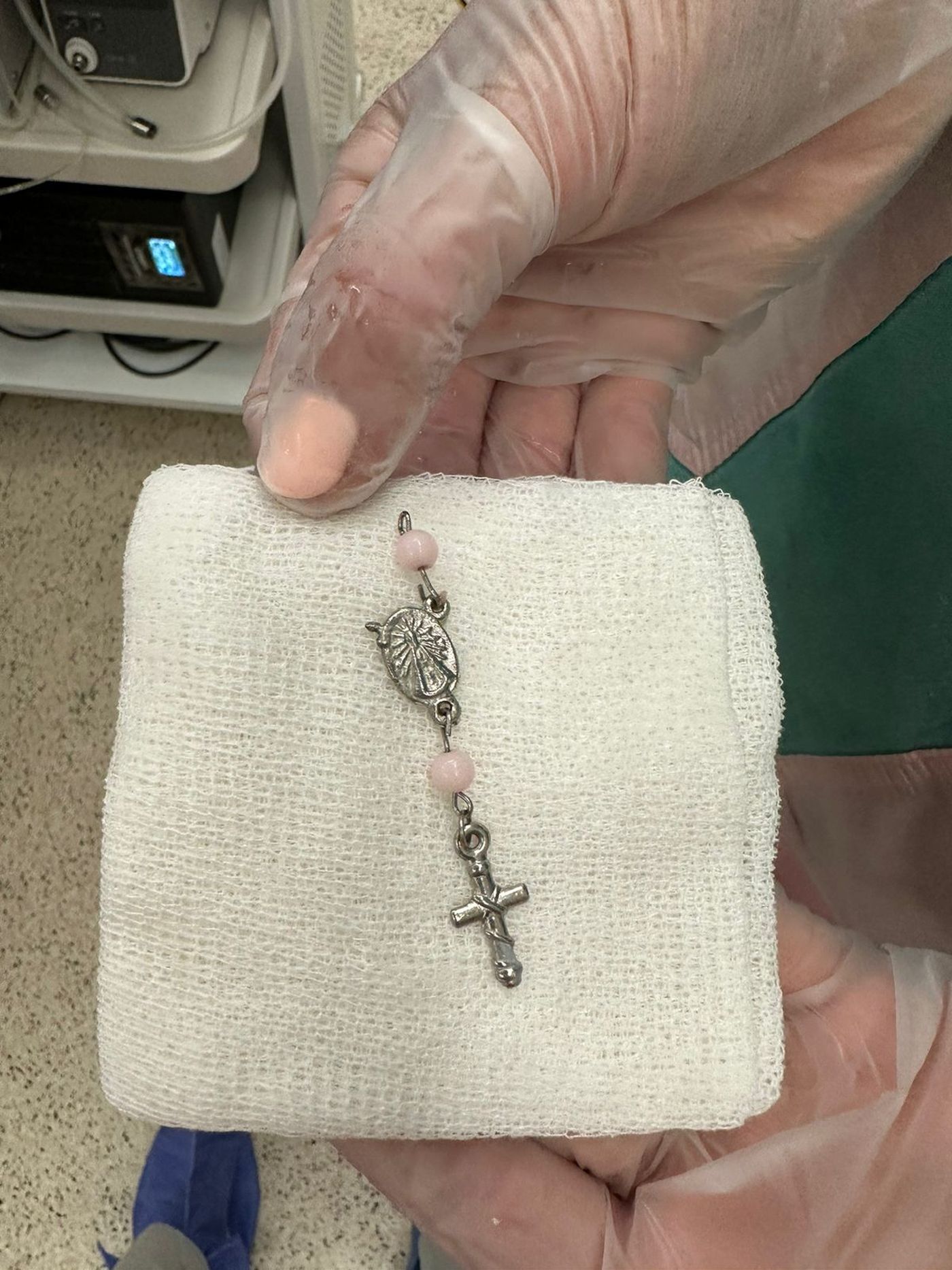 Uno de los objetos extraños extraídos en la guardia de endoscopía del Hospital de Niños.