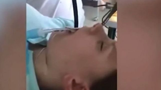 video: fue al hospital porque no podia respirar y le sacaron una serpiente de la garganta