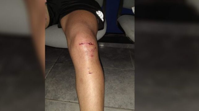 videos: denuncian que un auto atropello a dos motociclistas en la plata y se dio a la fuga