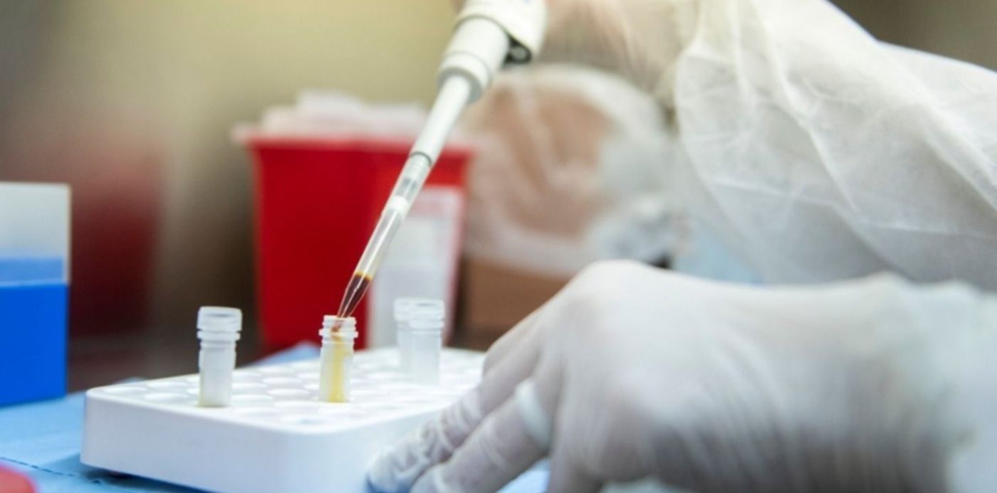 1585839940529.jpg?y=122&width=1274&scaleX=1&ow=1280&x=7&height=637&rotate=0&scaleY=1&oh=799&&cw=1920&ch=950