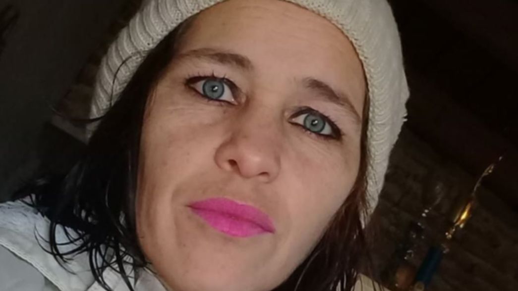 Se negó a declarar el acusado de quemar a su ex pareja en Romero y pidió pericias