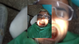 volvia de jugar al futbol en una cancha de la plata, lo confundieron con un ladron y le rompieron la mandibula volvia de jugar al futbol en una cancha de la plata, lo confundieron con un ladron y le rompieron la mandibula