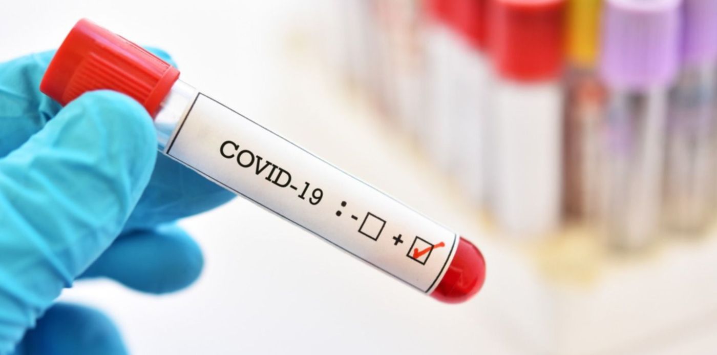 1585424742908.jpg?rotate=0&scaleX=1&ow=1500&oh=1000&x=10&y=117&width=1487&height=743&scaleY=1&&cw=1920&ch=950