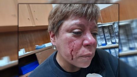Inspectora golpeada 1.jpg