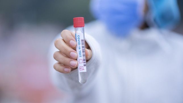 con el aporte de la unlp, investigadores crearon un test de covid mas rapido y economico