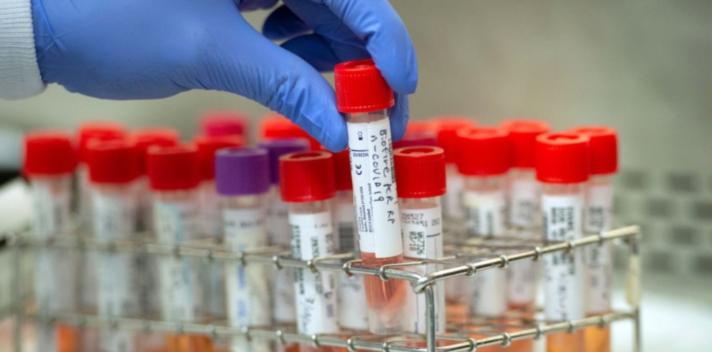 1585424745790.jpeg?x= 8&y=19&width=1503&height=752&rotate=0&scaleX=1&scaleY=1&ow=1500&oh=968&&cw=1920&ch=950