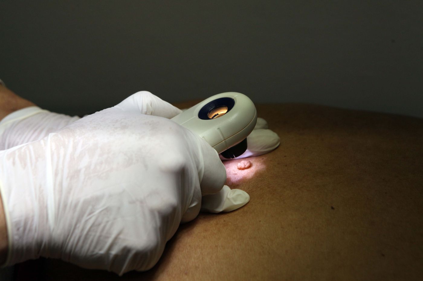 Campaña federal Salvá Tu Piel