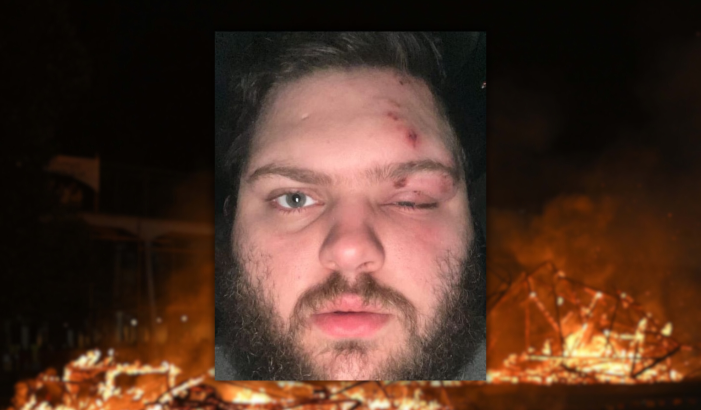 herido por pirotecnia en quema de muñeco 2026