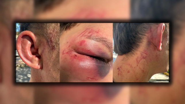 la influencer juana rodriguez denuncio que atacaron a su novio a la salida de un boliche