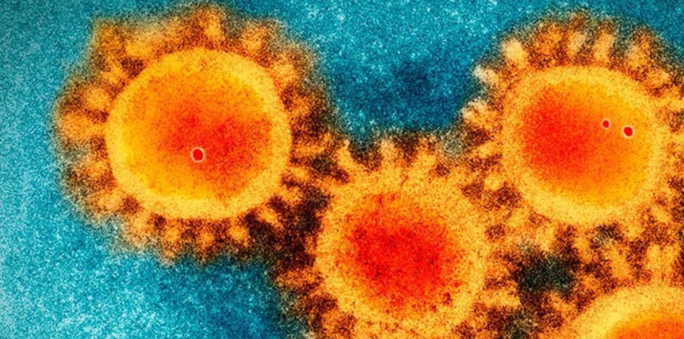 1600973482522.jpg?x=13&y=24&width=1176&height=588&rotate=0&scaleX=1&scaleY=1&ow=1200&oh=800&&cw=1920&ch=950