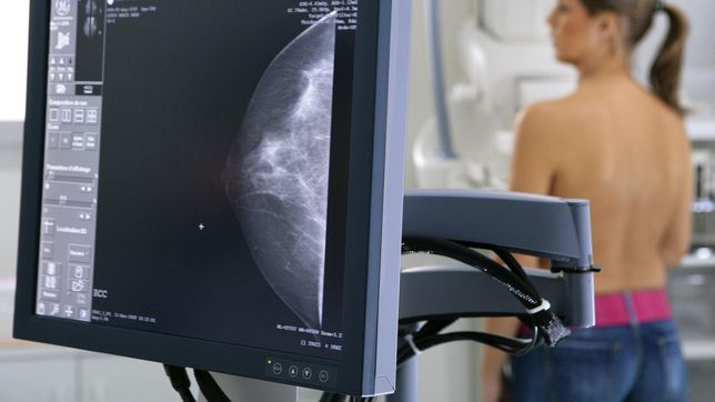 provincia redobla la prevencion del cancer de mama y adelanta 10 anos las indicaciones de mamografias