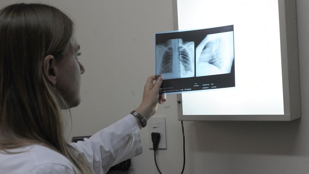 El Gobierno confirmó la libre elección de la obra social para quienes comienzan un trabajo