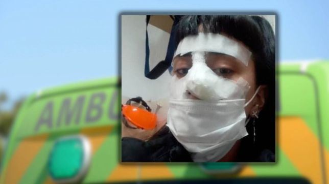 hasta que no termine muerta no va a parar: desfiguran a una joven en berisso