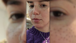 la dura carta de la joven de la plata que pidio que le resalten las pecas y terminaron arruinandole la cara