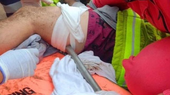 una sombrilla volo por una playa de mar del plata y se le clavo a un joven en la pierna