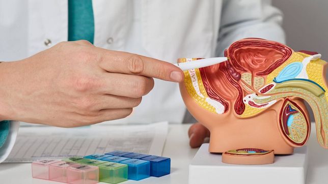 dia mundial del cancer de prostata: buscan concientizar sobre la importancia de la deteccion temprana