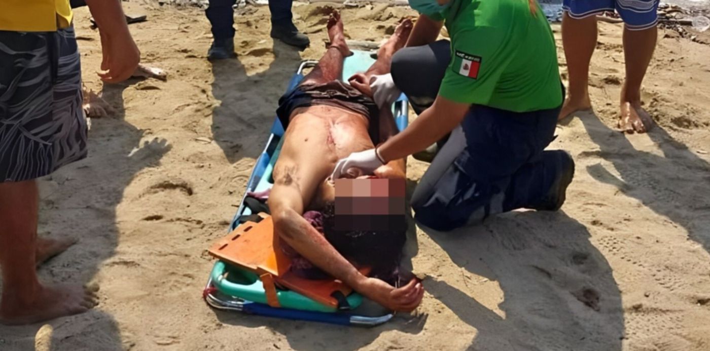 Machetazos contra argentinos