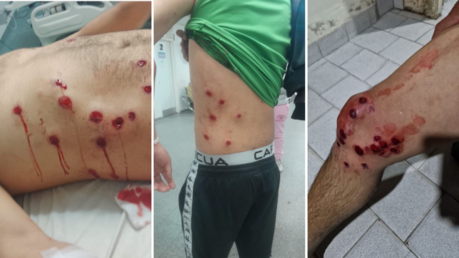 un enfrentamiento entre hinchadas de la liga amateur platense termino con represion y varios heridos con balas de goma