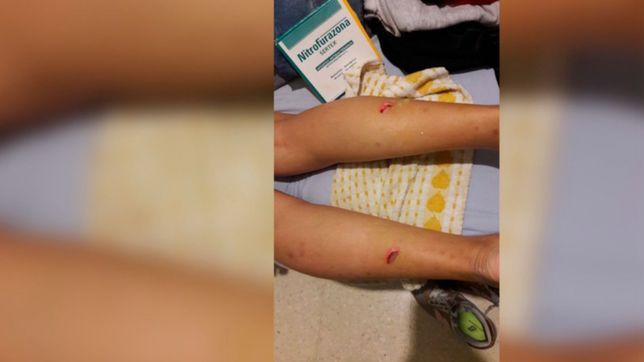 le cortaron las piernas en un boliche y un encargado la mando a ponerse la gotita