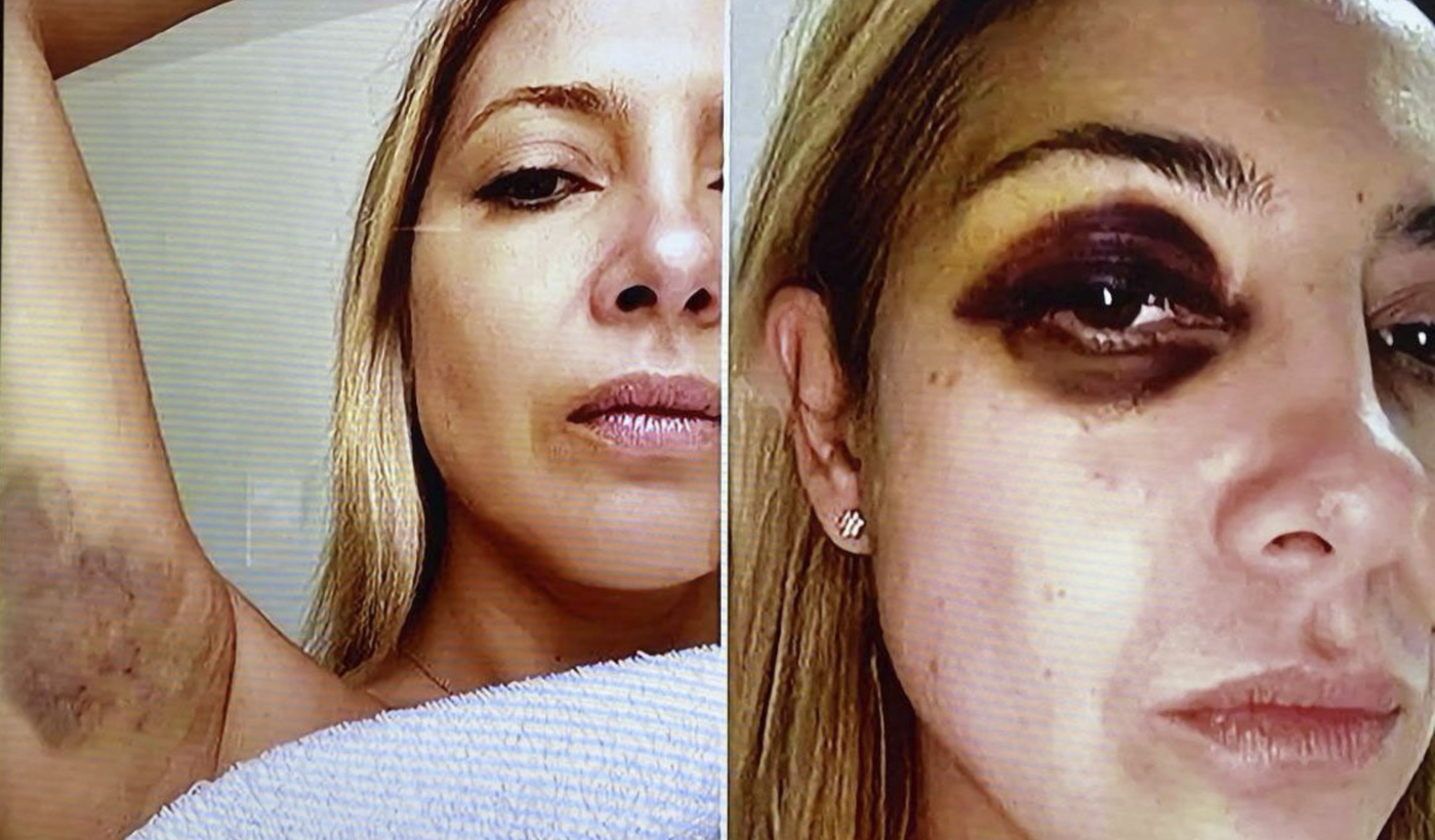 Tapa Fabiola Yañez golpeada.png