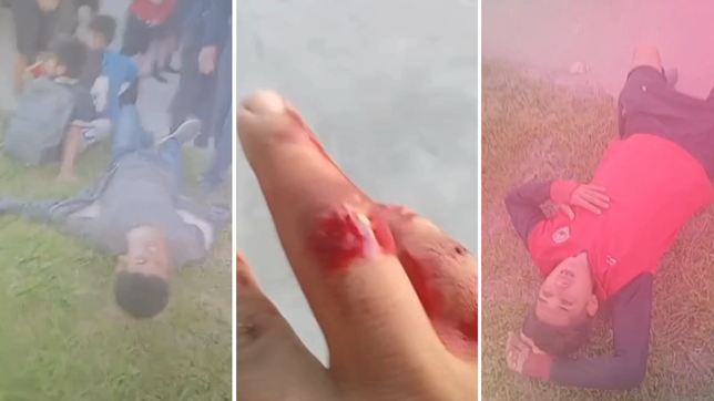 corridas, piedrazos y heridos tras un partido entre equipos de berisso y ensenada