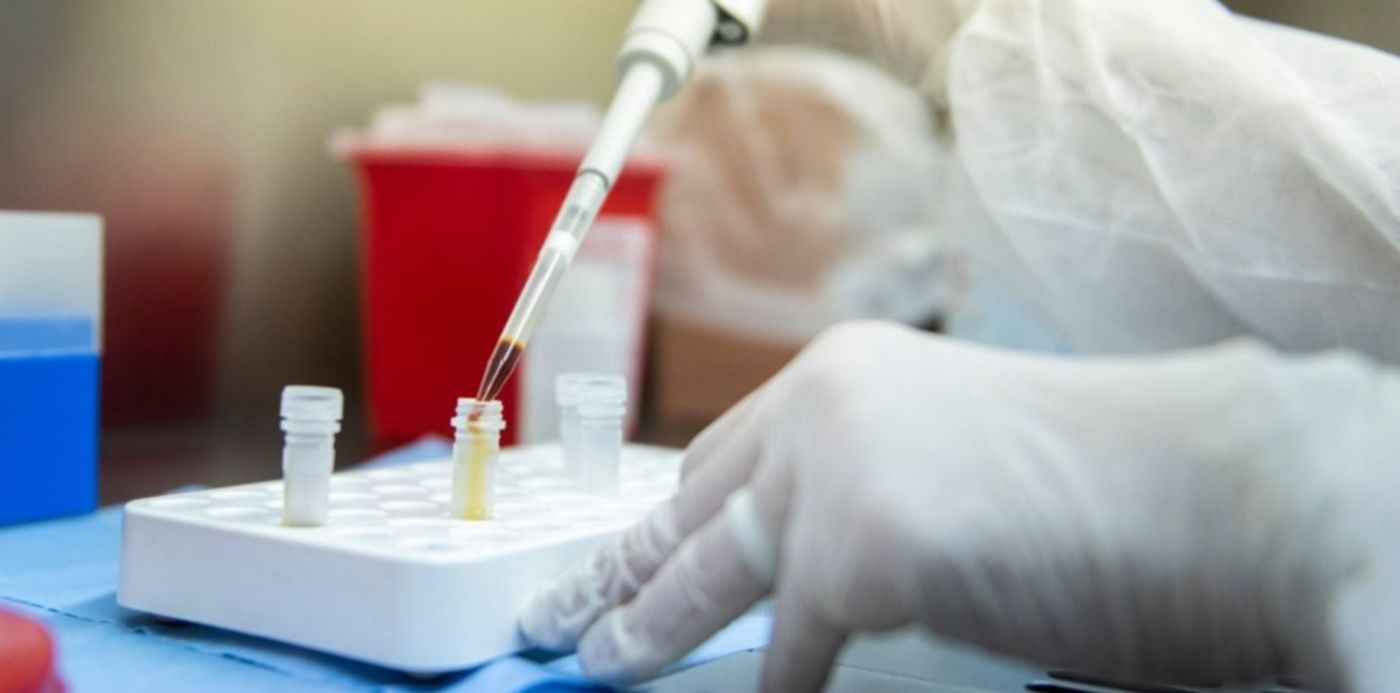 1585350783098.jpg?x=3&y=188&width=1291&height=645&rotate=0&scaleX=1&scaleY=1&ow=1280&oh=853&&cw=1920&ch=950